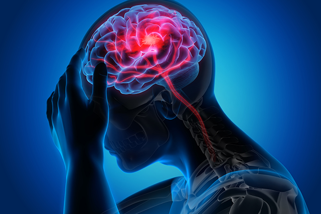 Neuroinflammation – Mechanisms, Causes, Manifestations