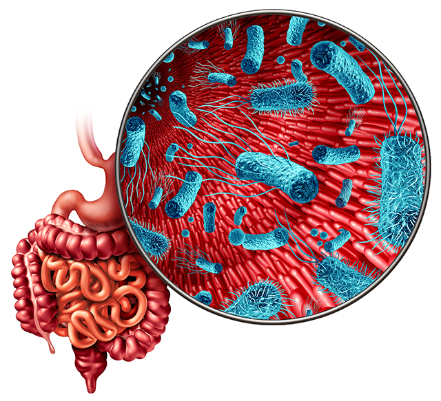 qPCR Analysis of the GI Microbiome and Naturopathic Management of Autoimmune Disease